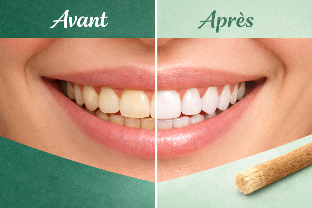 Siwak dent avant après : la preuve en images