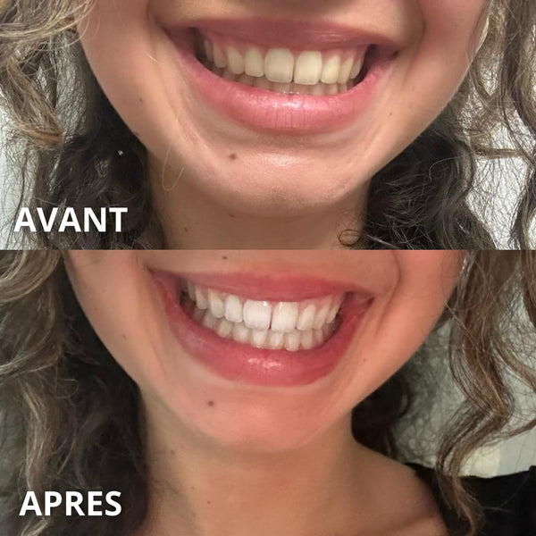 Dentifrice au Siwak