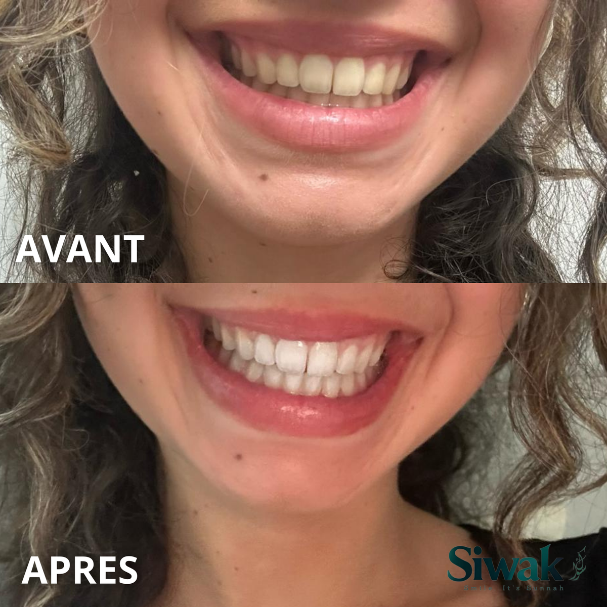 Pack Challenge dents blanches 28 jours