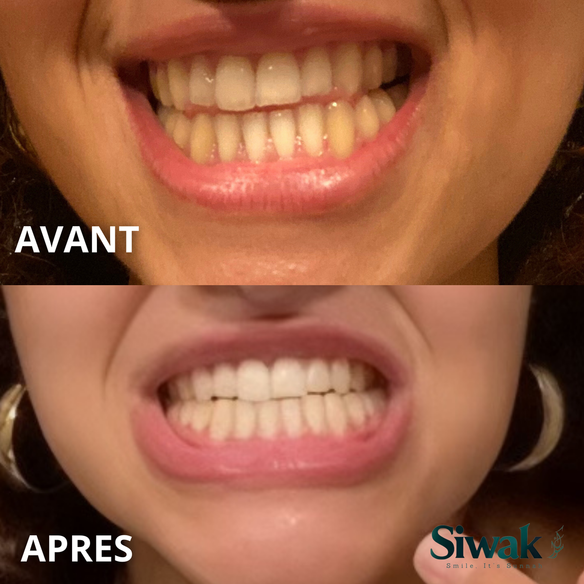 Pack Challenge dents blanches 28 jours