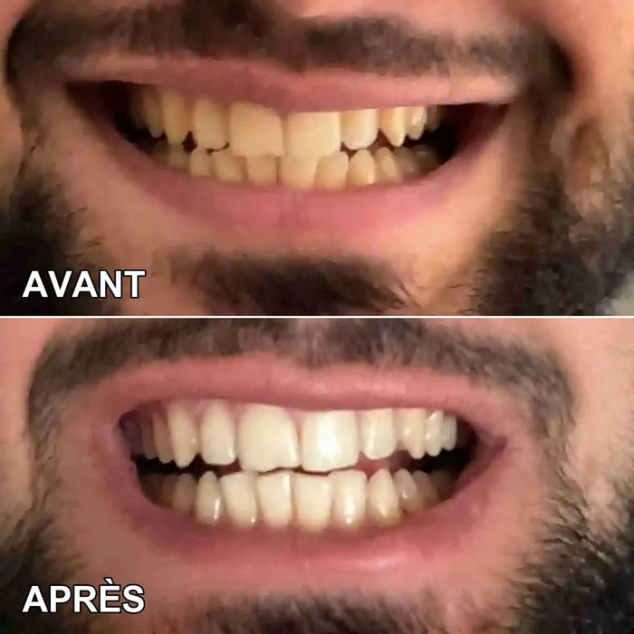 Avant et après d’Adam